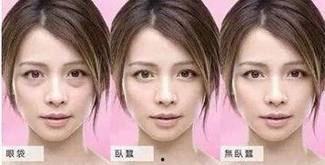 有眼袋的照片,照片解析下的眼部肌肤问题